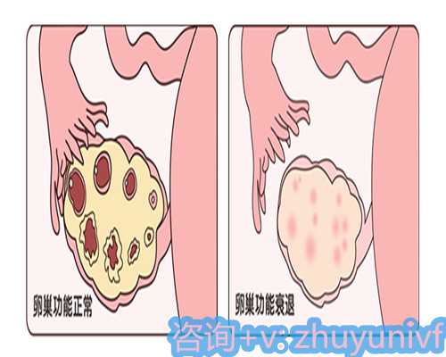 子宫息肉不用担心！手术治疗配合食物调理轻松搞定