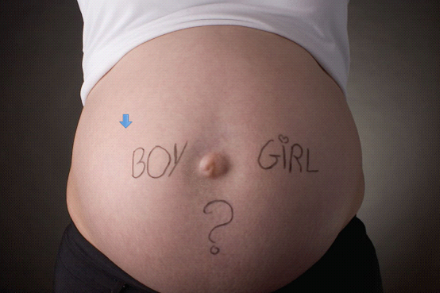 自然周期移植打绒促的原因？自然周期盲目使用绒促不可取！