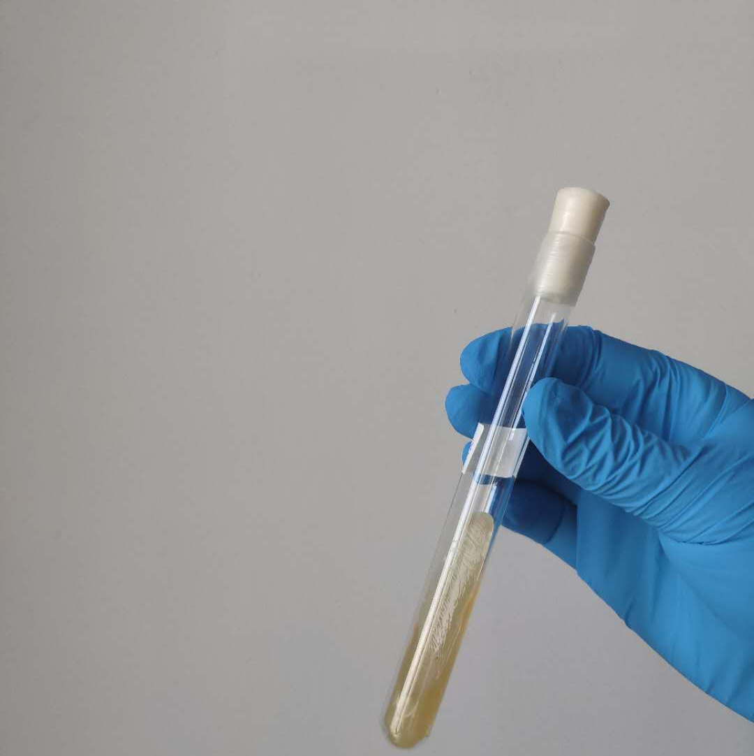 重庆代生哪里成功率高 重庆某医院备孕检查项目费用明细 ‘怎么看nt结果看男