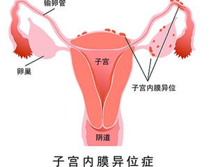 重庆代生最新价格表 重庆妇幼保健院试管费用高吗? ‘b超三根线看男女图片大