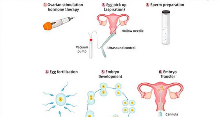 找人代怀~深圳哪家医院做试管婴儿的技术好？