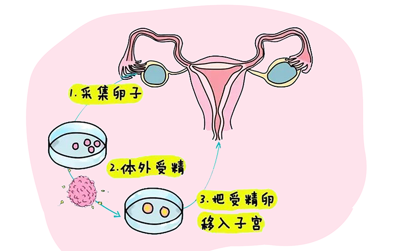 深圳试管婴儿医保能报销吗
