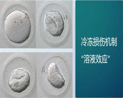 重庆代生孩子经历 重庆市计生医院推荐理由 ‘46*47*33孕囊是男宝还是女宝’