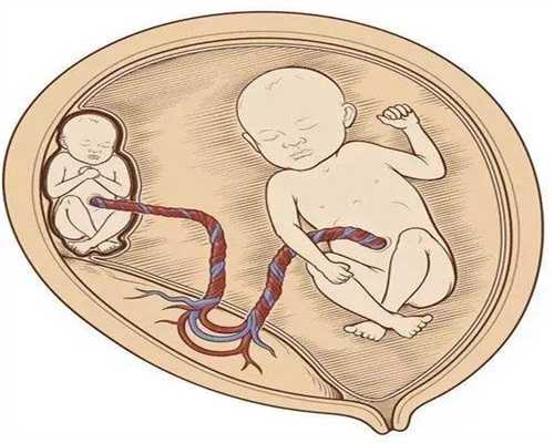 重庆借卵子生子的年龄 重庆试管婴儿医院费用受影响如何? ‘孕妇三维彩超看男